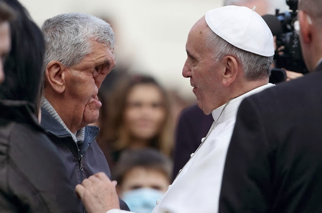 Papa Francisco beija homem com rosto desfigurado e dá lição de moral em muitos pastores