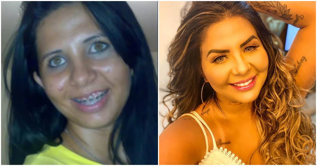 Renallida Carvalho antes e depois