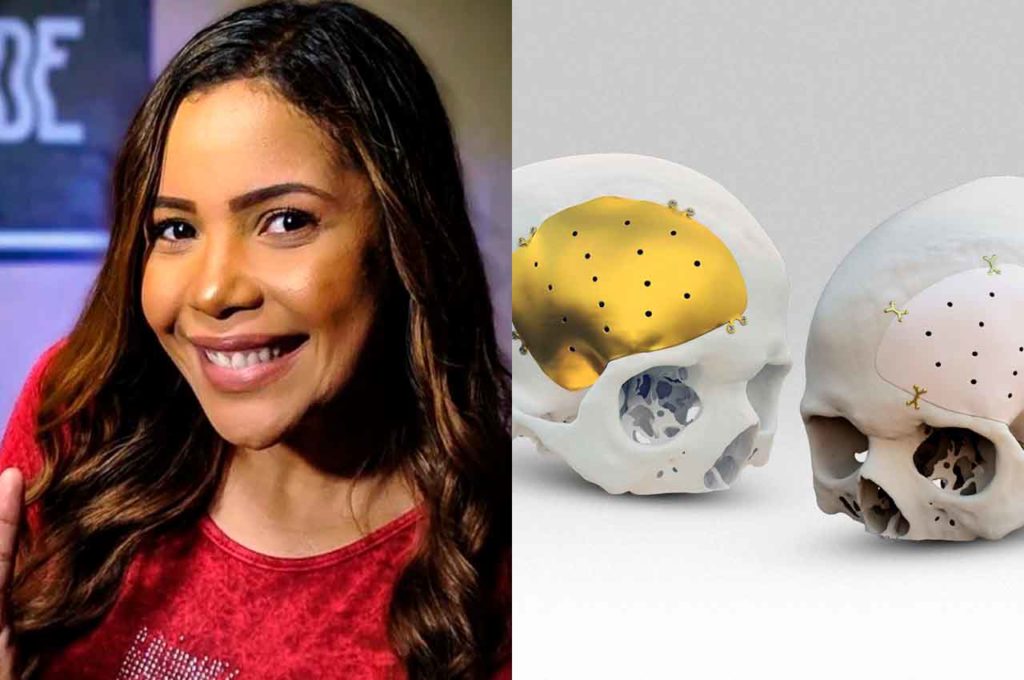 Amanda Wanessa e imagem ilustrativa de prótese