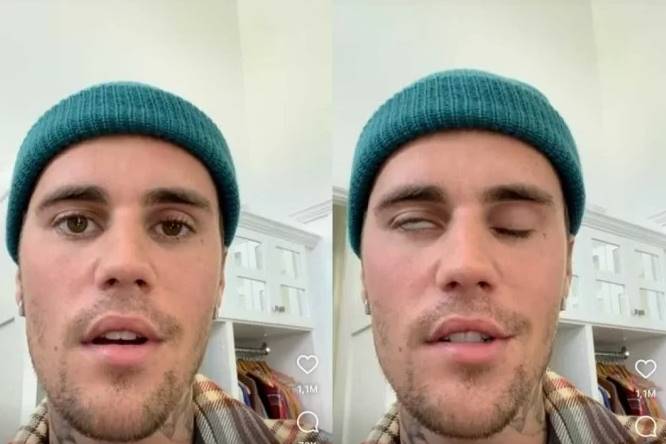 Justin Bieber pede orações ao revelar paralisia facial
