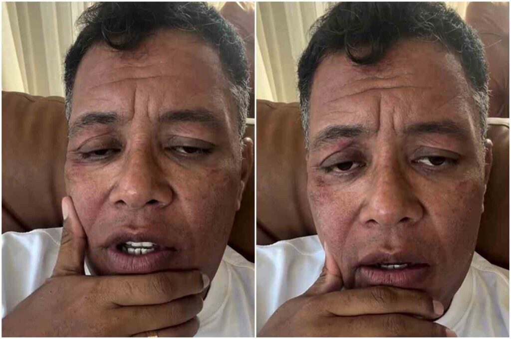 Anderson Freire aparece em vídeo com expressão séria, apoiando a mão no rosto.