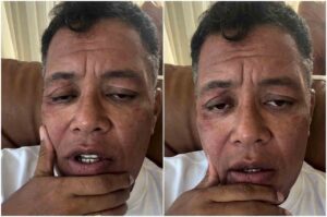 Anderson Freire aparece em vídeo com expressão séria, apoiando a mão no rosto.