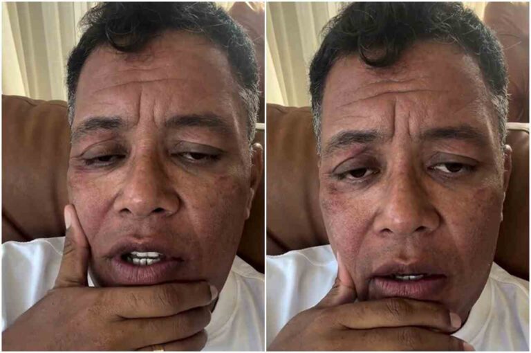 Anderson Freire enfrenta alergia grave e expõe descaso em hospital particular